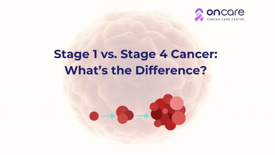 Stage 1 Cancer Vs Stage 4 Cancer What s The Difference stage-1-cancer-vs-stage-4-cancer-what-s-the-difference